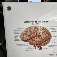 The Brain 3D Raised Relief Chart by Anatomical Chart Company (2004, Wallchart)