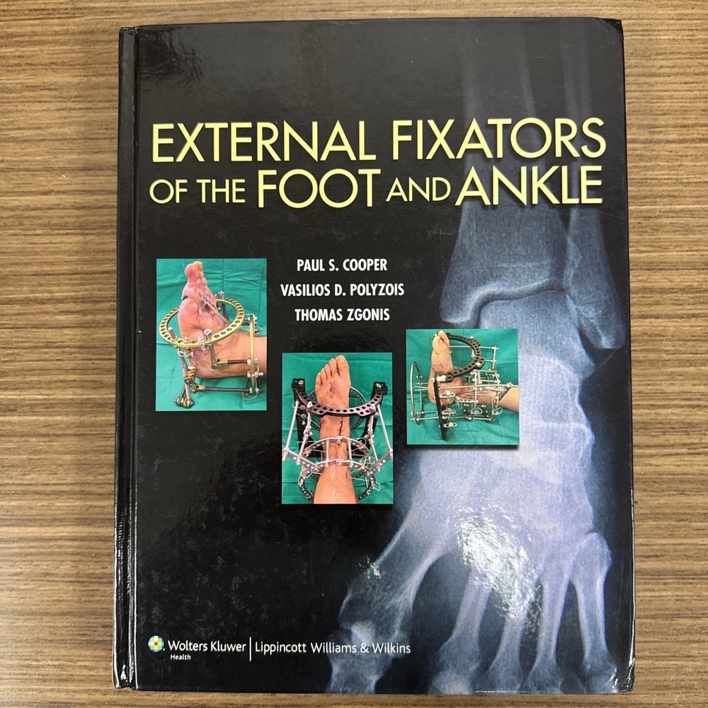 External Fixators of the Foot and Ankle by Thomas Zgonis,