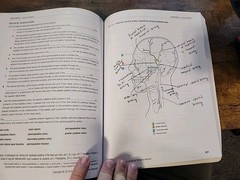 Dental Anatomy Coloring Book – Paperback, by Fehrenbach RDH MS Margaret – ACCEPT