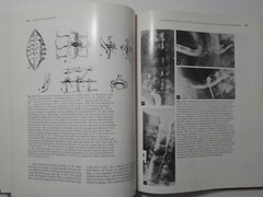 The Cervical Spine by The Cervical Spine Research Society, 1983, Like New
