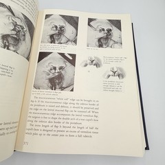 Cleft Craft Vol 2 Evolution Of Its Surgery The Unilateral Deformity Millard 1977