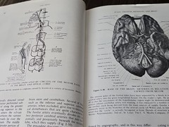 Surgical Anatomy Volume 1+2 Book Anson McVay 1971 GC HC