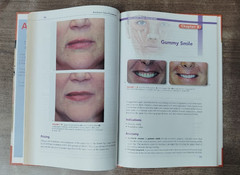 Botulinum Toxin Procedures Rebecca Small MD Hardcover Medical Aesthetic Guide US