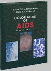 COLOR ATLAS OF AIDS, 2E By Friedman-kien Alvin E. Md & Cockerell Clay J. Md *VG*