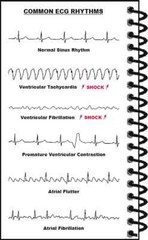Maxwell Quick Medical Reference Pocket, 7th Edition Spiral-bound