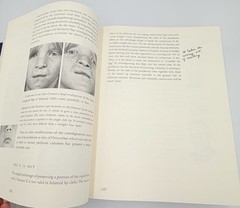 Cleft Craft Vol 2 Evolution Of Its Surgery The Unilateral Deformity Millard 1977