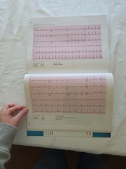 Basic Arrhythmias With 12-Lead EKGs 8th Edition Paperback By Walraven, Gail
