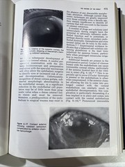 Corneal Disorders: Clinical Diagnosis and Management by Howard M. Leibowitz