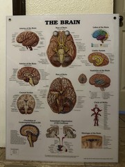 The Brain 3D Raised Relief Chart by Anatomical Chart Company (2004, Wallchart)