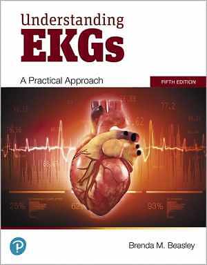 Understanding EKGs: A Practical Approach – Paperback, by Beasley Brenda – Good o