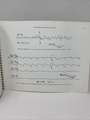 Fundamentals EEG Technology Vol 1 Tyner Spiral Bound 1985 Raven Press Lippincott