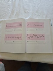 Basic Arrhythmias With 12-Lead EKGs 8th Edition Paperback By Walraven, Gail