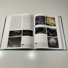 Pediatric Sonography Fifth Edition by Marilyn J. Siegel, MD Hardcover w/ Code 5e