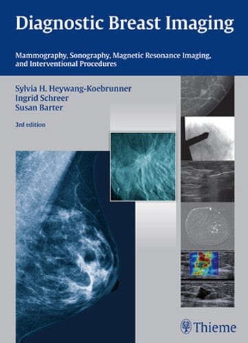 Diagnostic Breast Imaging: Mammography, Sonography, MRI and Interventional: Used