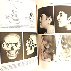 Vintage Cleft Lip and Palate Surgical Dental and Speech Book Hardcover 1971