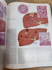 The CIBA Collection Of Medical Illustrations Volume 3 Digestive System 1964