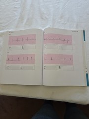 Basic Arrhythmias With 12-Lead EKGs 8th Edition Paperback By Walraven, Gail