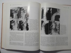 The Cervical Spine by The Cervical Spine Research Society, 1983, Like New