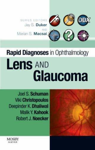 Lens and Glaucoma