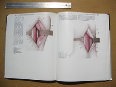 Atlas of Microvascular Surgery : Anatomy of Operative Approaches First Edition