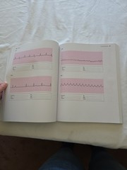 Basic Arrhythmias With 12-Lead EKGs 8th Edition Paperback By Walraven, Gail