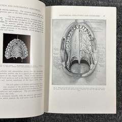Conduction Infiltration General Anesthesia Dentistry 1943 4th Nevin & Puterbaugh