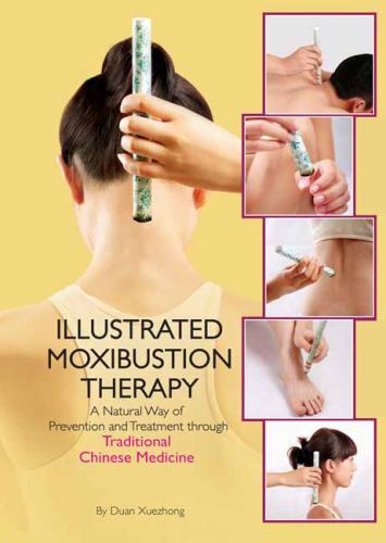 Illustrated Moxibustion Therapy: A Natural Way of Prevention and Treatment throu