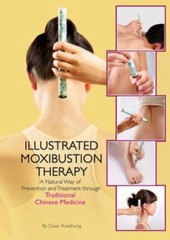 Illustrated Moxibustion Therapy: A Natural Way of Prevention and Treatment throu