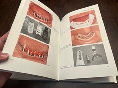 Tissue-Integrated Prostheses Osseointegration In clinical dentistry, Illustrated