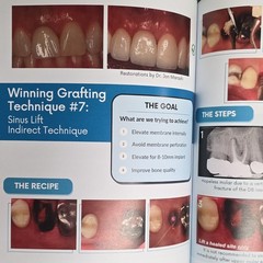 Winning Surgical Techniques Suturing Bone Grafting Implants PB Simon