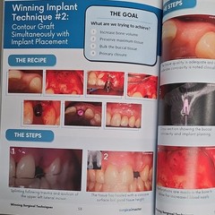 Winning Surgical Techniques Suturing Bone Grafting Implants PB Simon