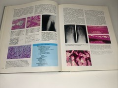 ATLAS OF ORTHOPEDIC PATHOLOGY: WITH CLINICAL AND By Peter G. Bullough & Vigorita
