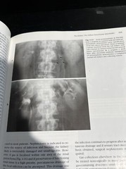 OOP 1st/2nd Genitourinary Radiology by Ronald J. Zagoria & Glenn Tung HC NO DJ