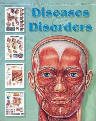 Diseases & Disorders : The World’s Best Anatomical Charts Collection