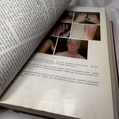 Harrison’s Principles of Internal Medicine, Fifth Edition 1966 (Vol.1 & Vol.2)