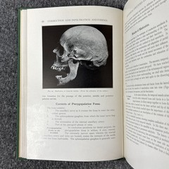 Conduction Infiltration General Anesthesia Dentistry 1943 4th Nevin & Puterbaugh