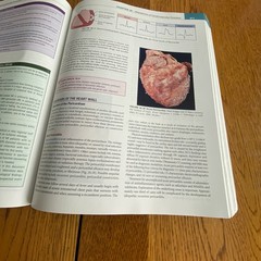 Understanding Pathophysiology 7th Edition Paperback