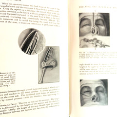 Vintage Plastic and Reconstructive Surgery 3rd Edition Book Hardcover 1971 Hans