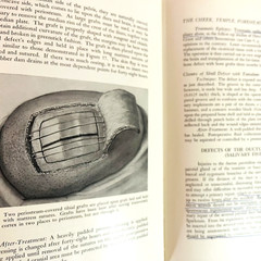 Vintage Plastic and Reconstructive Surgery 3rd Edition Book Hardcover 1971 Hans