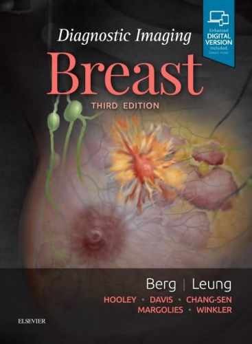 Diagnostic Imaging: Breast – Hardcover, by Berg Wendie A.; Leung – Very Good
